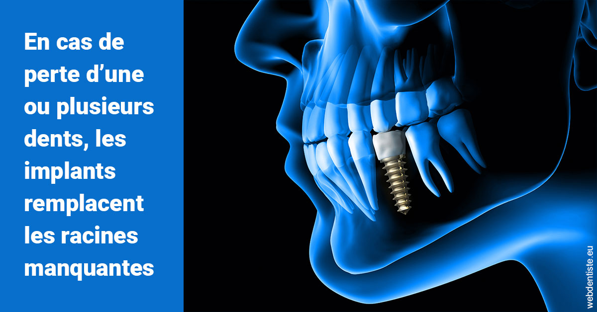 https://www.simon-orthodontiste.fr/Les implants 1