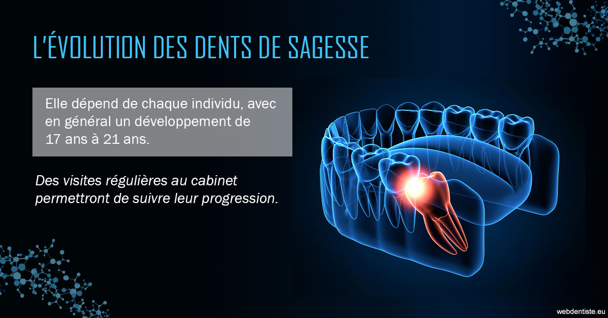 https://www.simon-orthodontiste.fr/2023 T4 - Dents de sagesse 01