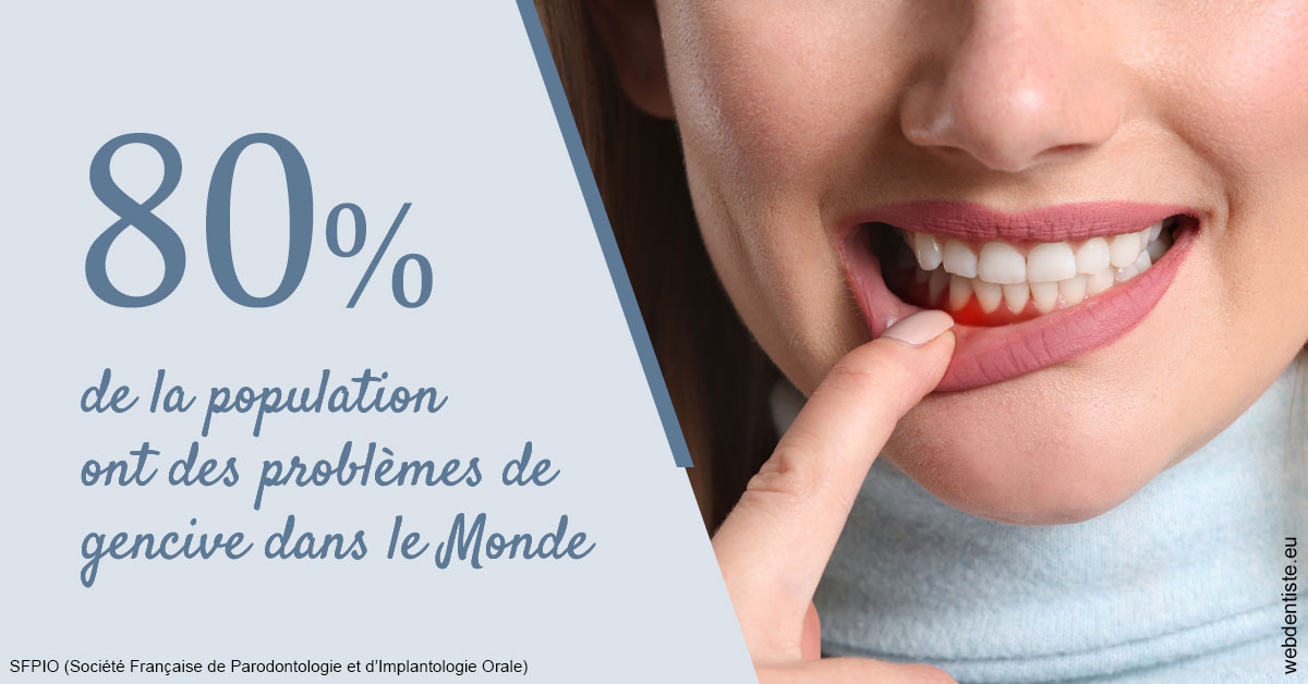 https://www.simon-orthodontiste.fr/Problèmes de gencive 2