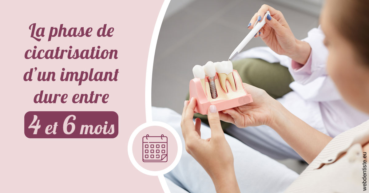 https://www.simon-orthodontiste.fr/Cicatrisation implant 2