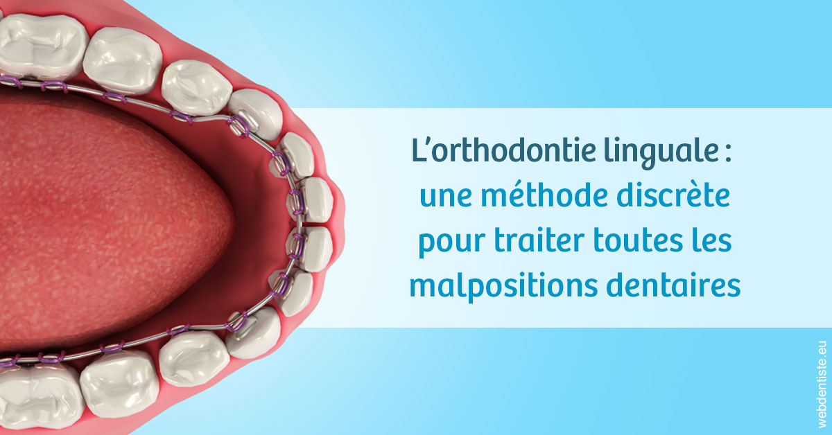 https://www.simon-orthodontiste.fr/L'orthodontie linguale 1