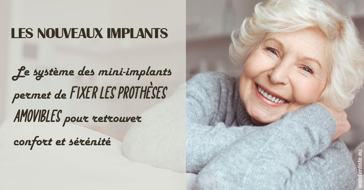 https://www.simon-orthodontiste.fr/Les nouveaux implants 1