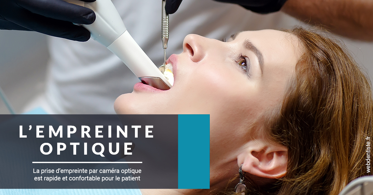 https://www.simon-orthodontiste.fr/L'empreinte Optique 1
