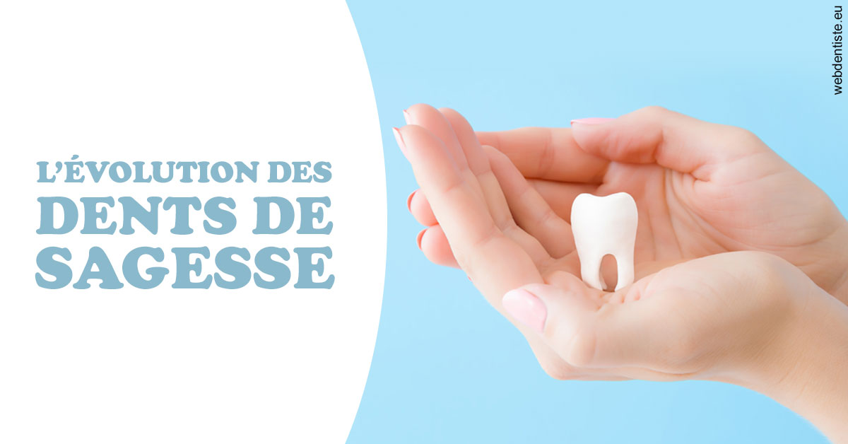 https://www.simon-orthodontiste.fr/Evolution dents de sagesse 1