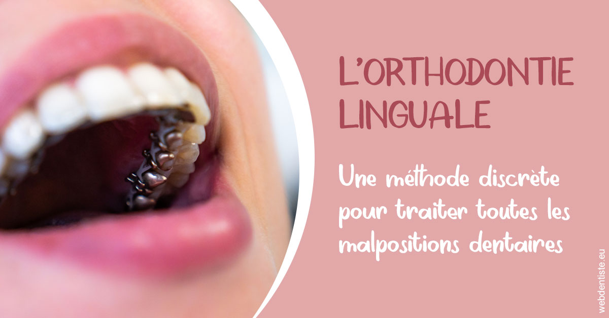 https://www.simon-orthodontiste.fr/L'orthodontie linguale 2