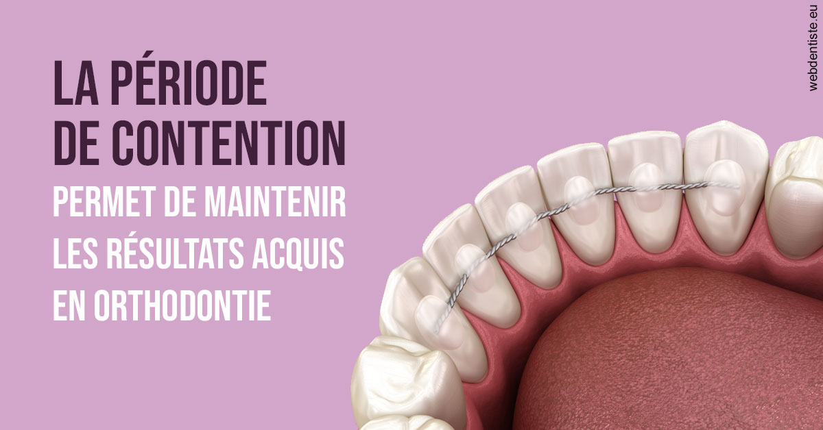 https://www.simon-orthodontiste.fr/La période de contention 2
