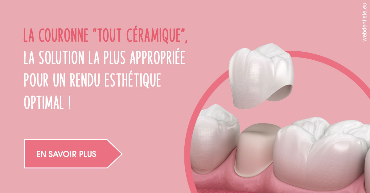https://www.simon-orthodontiste.fr/La couronne "tout céramique"