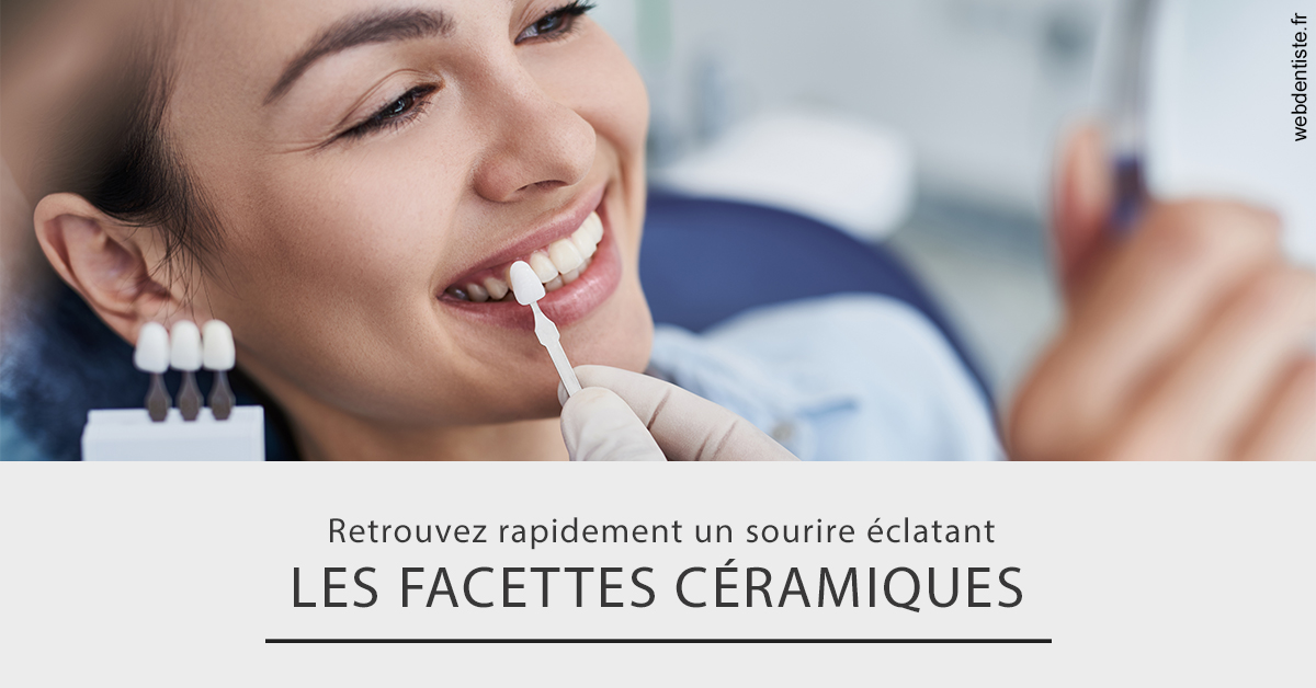 https://www.simon-orthodontiste.fr/Les facettes céramiques 2