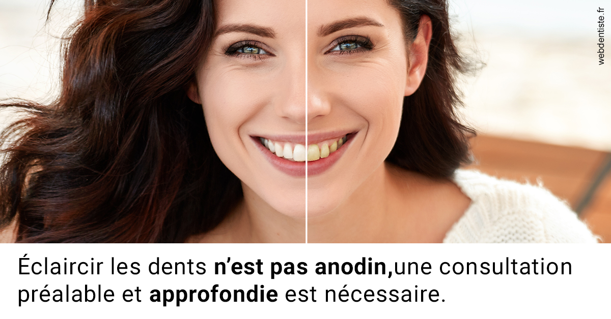 https://www.simon-orthodontiste.fr/Le blanchiment 2