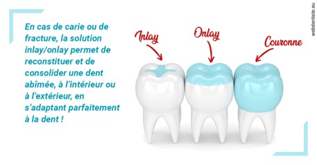 https://www.simon-orthodontiste.fr/L'INLAY ou l'ONLAY