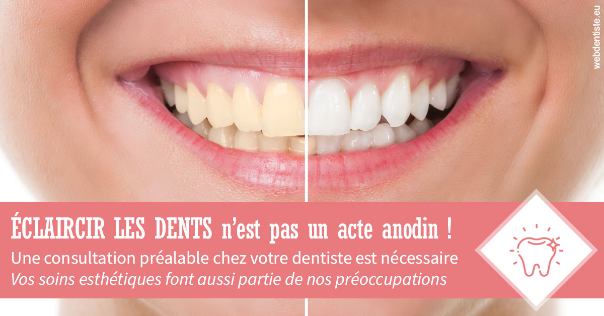 https://www.simon-orthodontiste.fr/Eclaircir les dents 1
