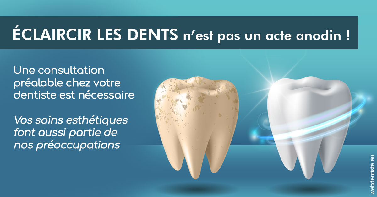 https://www.simon-orthodontiste.fr/Eclaircir les dents 2