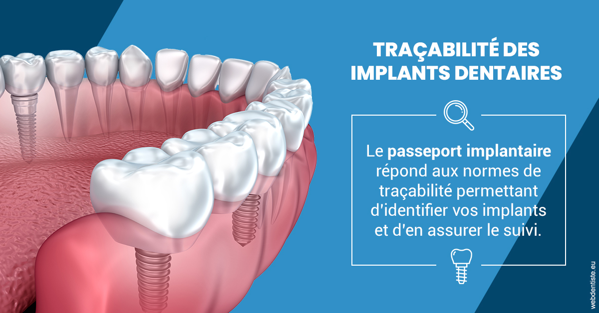 https://www.simon-orthodontiste.fr/T2 2023 - Traçabilité des implants 1