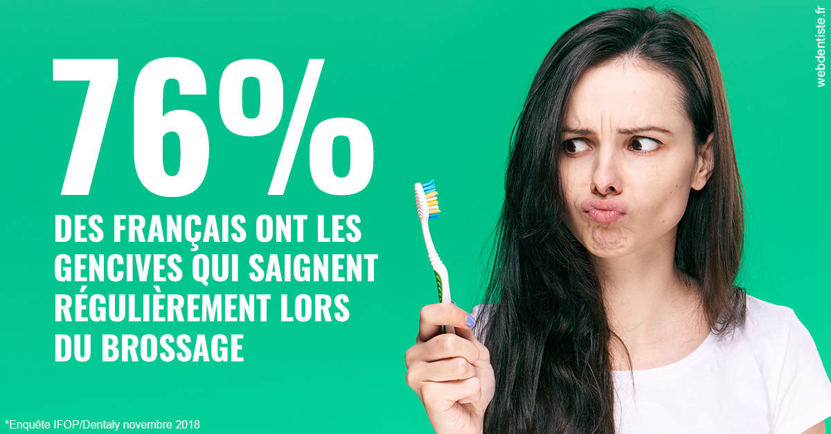 https://www.simon-orthodontiste.fr/76% des Français 1