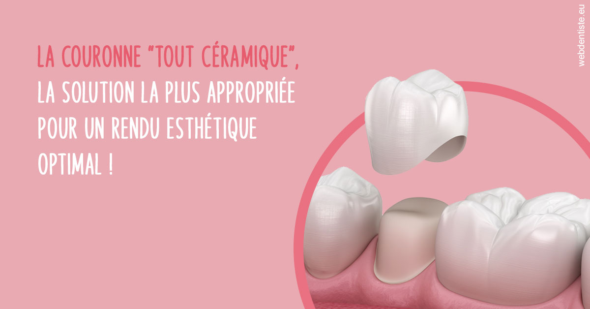 https://www.simon-orthodontiste.fr/La couronne "tout céramique"