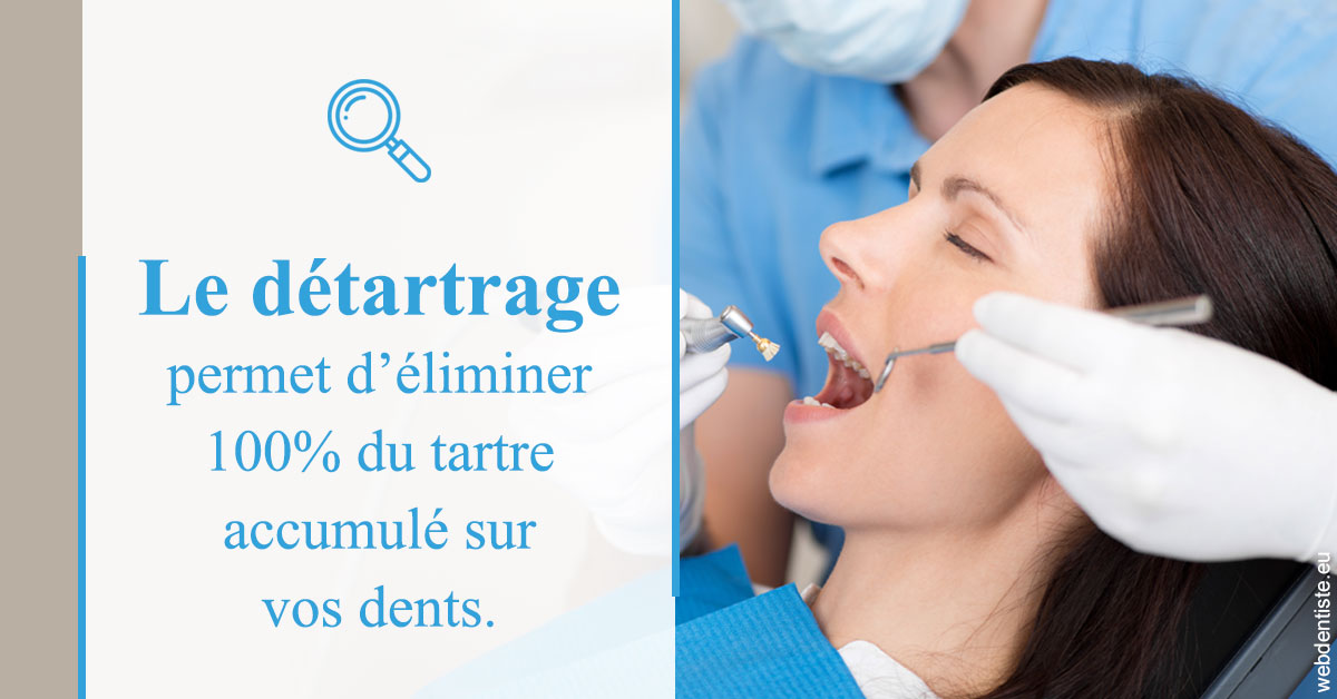 https://www.simon-orthodontiste.fr/En quoi consiste le détartrage