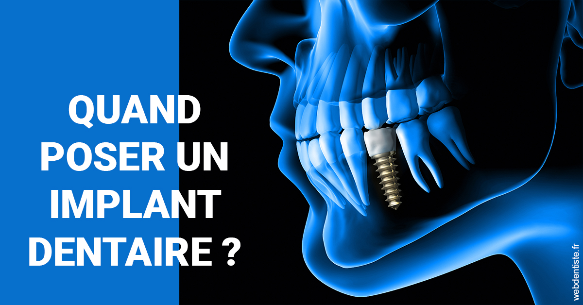 https://www.simon-orthodontiste.fr/Les implants 1