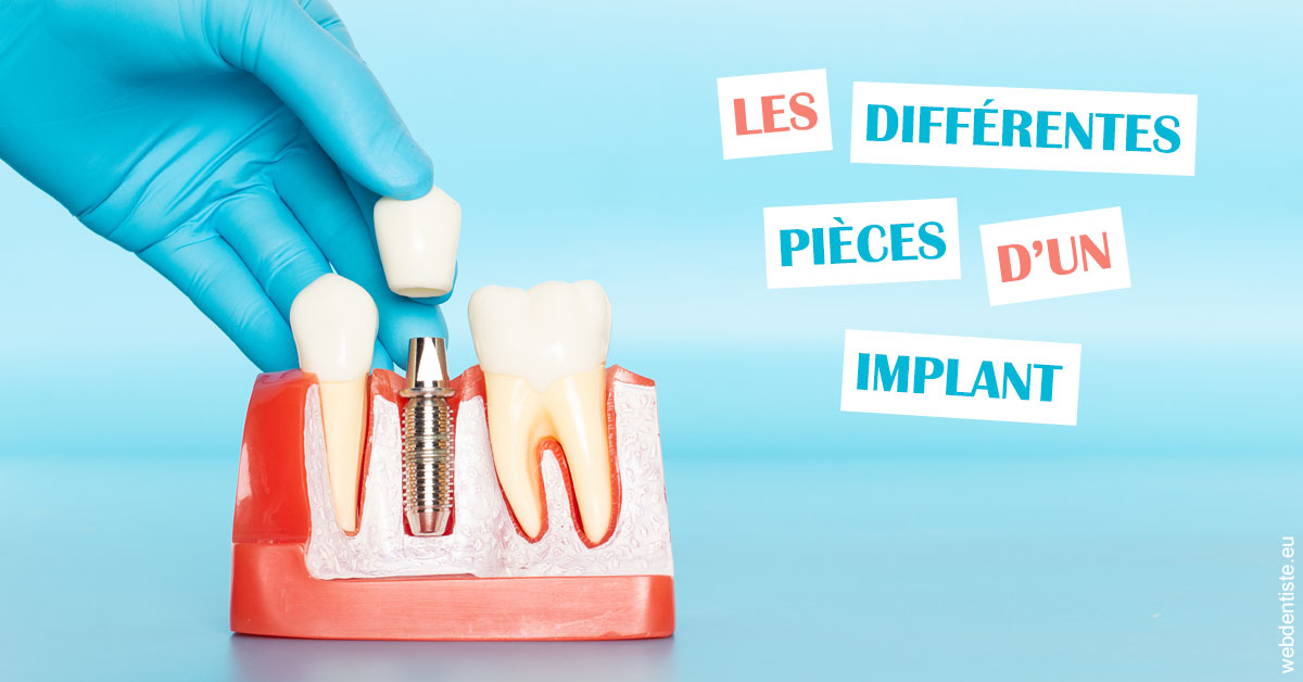 https://www.simon-orthodontiste.fr/Les différentes pièces d’un implant 2