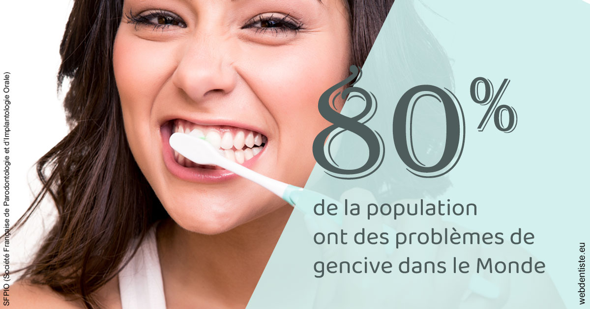 https://www.simon-orthodontiste.fr/Problèmes de gencive 1