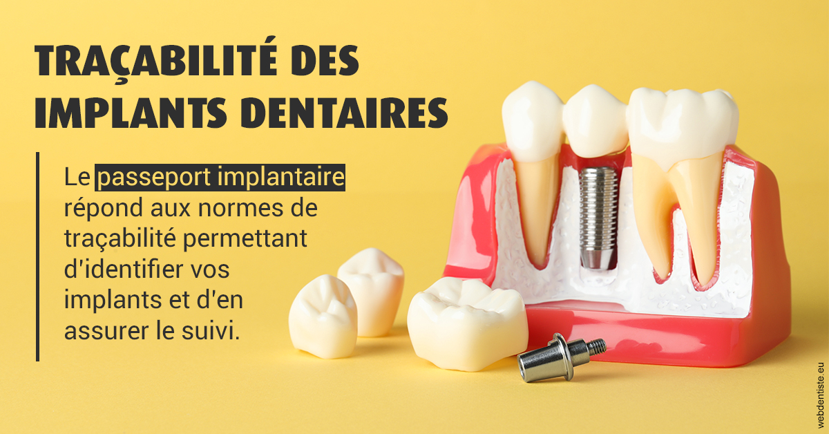 https://www.simon-orthodontiste.fr/T2 2023 - Traçabilité des implants 2