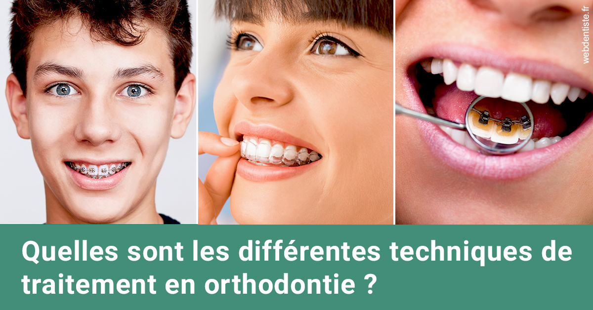 https://www.simon-orthodontiste.fr/Les différentes techniques de traitement 2