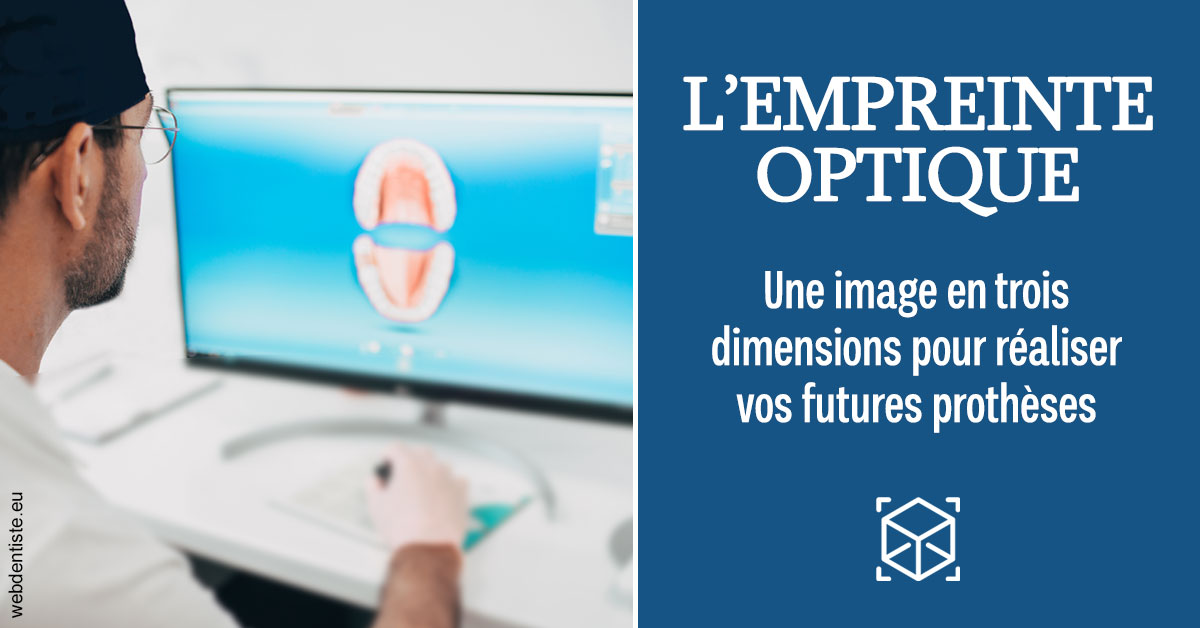 https://www.simon-orthodontiste.fr/Empreinte optique 2