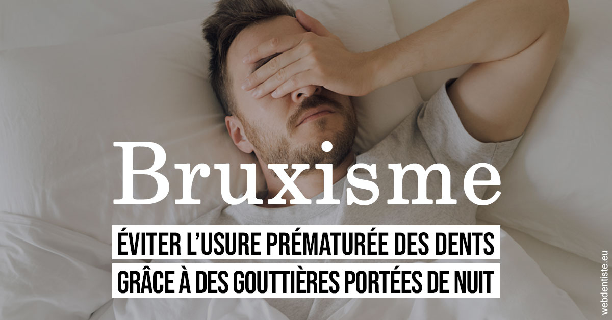 https://www.simon-orthodontiste.fr/Bruxisme 1