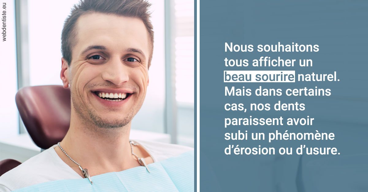 https://www.simon-orthodontiste.fr/Érosion et usure dentaire