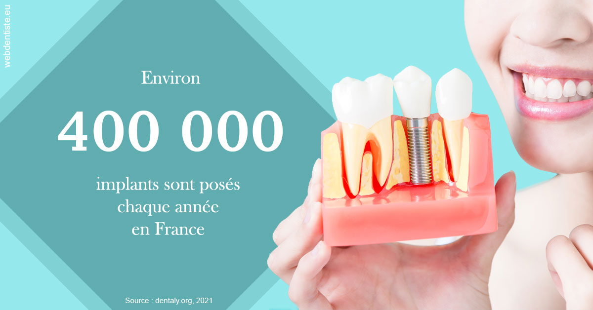 https://www.simon-orthodontiste.fr/Pose d'implants en France 2
