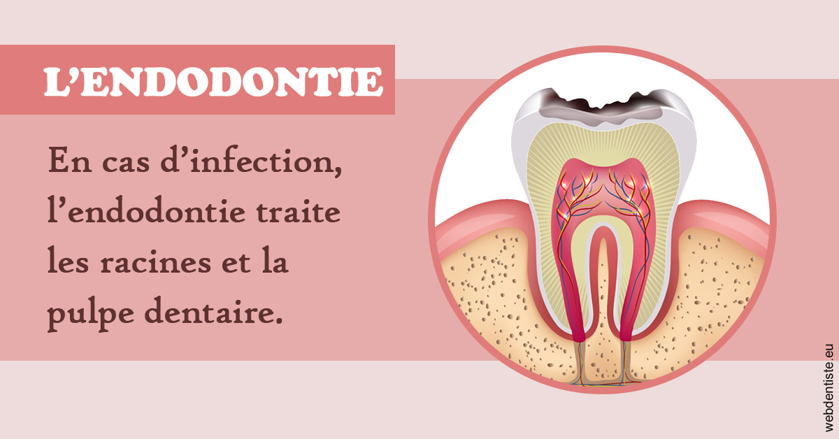 https://www.simon-orthodontiste.fr/L'endodontie 2