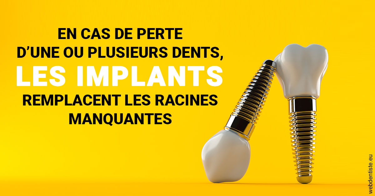 https://www.simon-orthodontiste.fr/Les implants 2