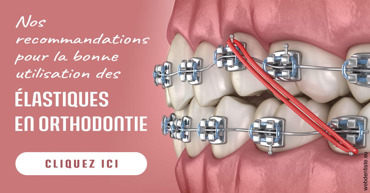 https://www.simon-orthodontiste.fr/Elastiques orthodontie 2