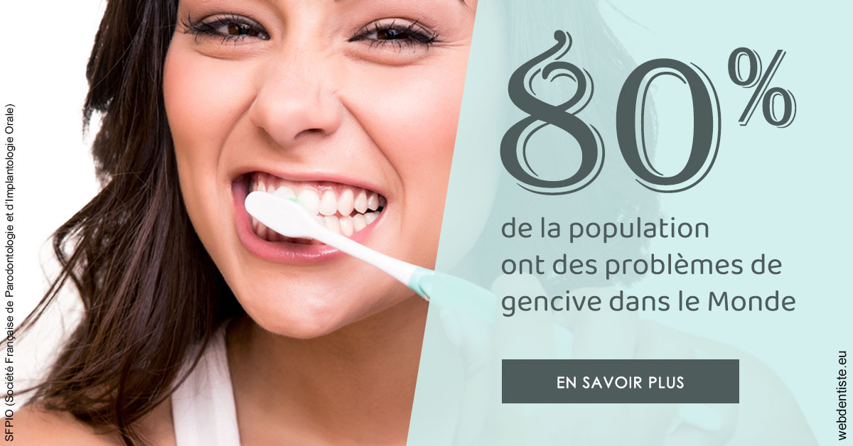 https://www.simon-orthodontiste.fr/Problèmes de gencive 1